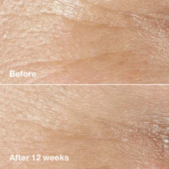 Clinique Smart Clinical Repair Wrinkle Correcting Cream - All Skin Types 50ml -Sigma Store Clinique Smart Clinical Repair Wrinkle Correcting Cream All Skin Types 50ml 5