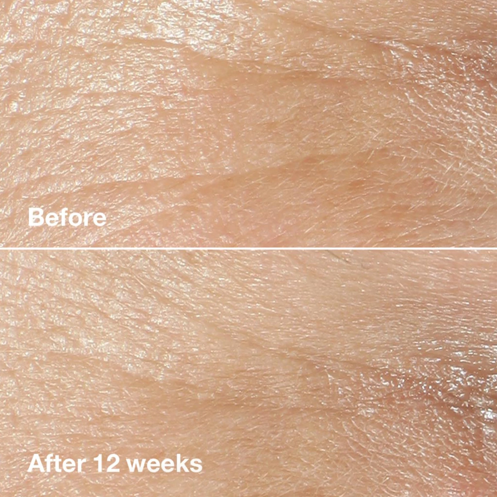 Clinique Smart Clinical Repair Wrinkle Correcting Cream - All Skin Types 50ml - Image 5