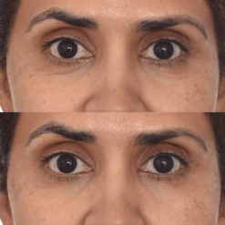 Murad Retinol Youth Renewal Eye Masks 5 Pack -Sigma Store Murad Retinol Youth Renewal Eye Masks 5 Pack ba