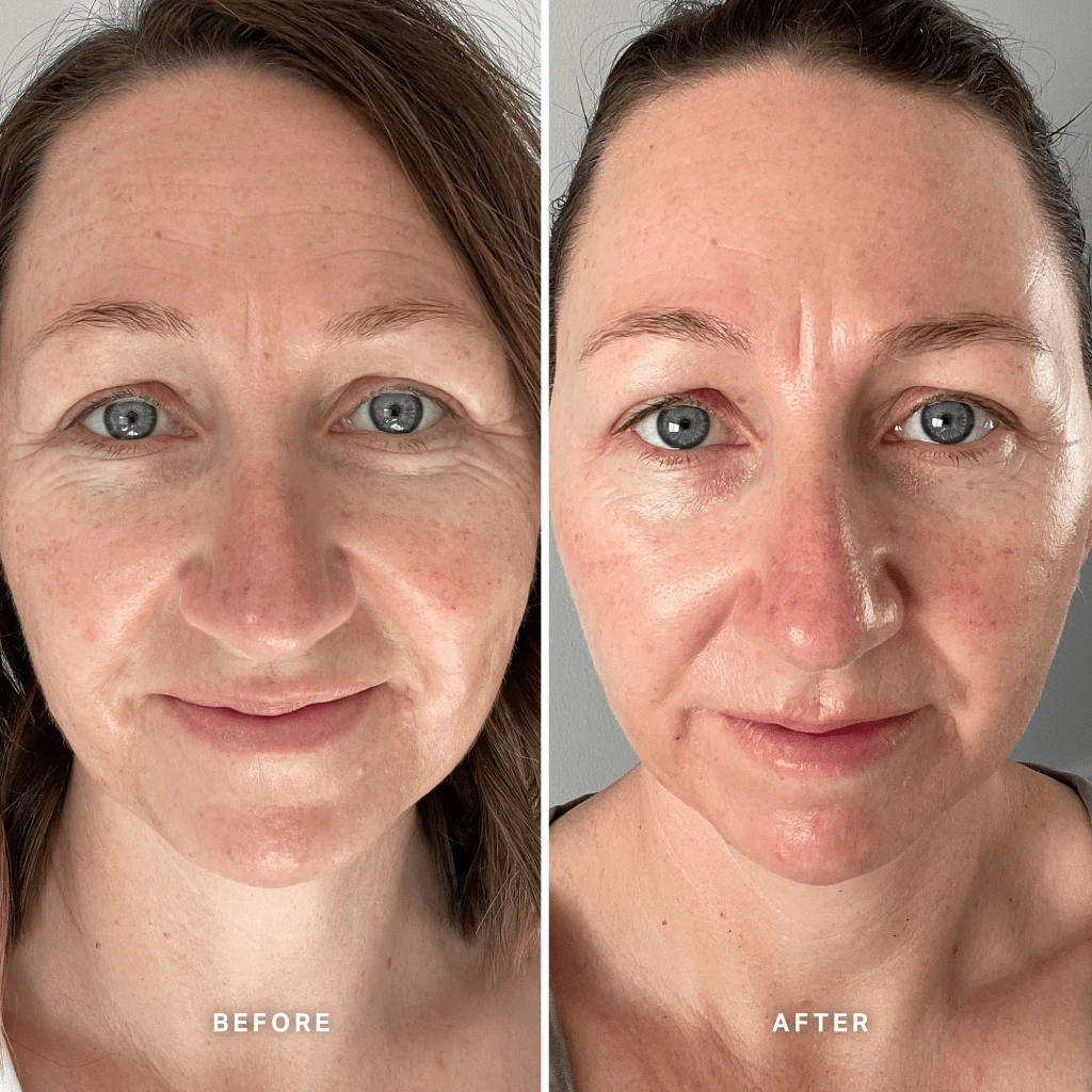 Alpha-H Vitamin E Serum With 1% Ceramide Complex 25ml 7 Alpha-H Vitamin E Serum With 1% Ceramide Complex 25ml - Image 7