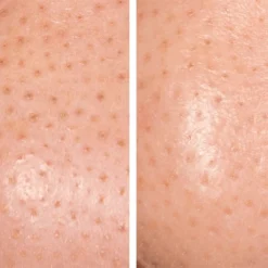 HydroPeptide Bambusa Blackhead Banisher Pore Perfecting Nose Mask 13 HydroPeptide Bambusa Blackhead Banisher Pore Perfecting Nose Mask -Sigma Store hydro4